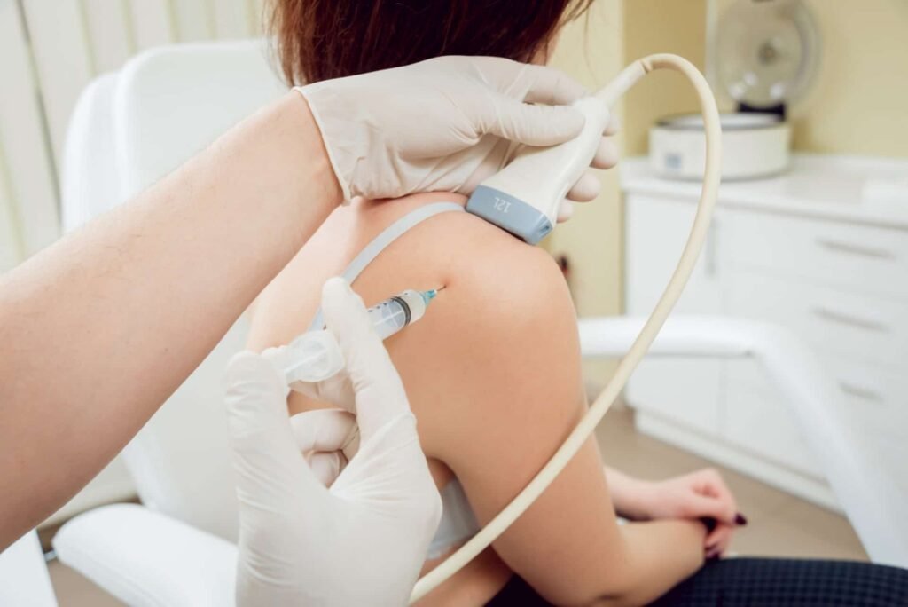 prp treatment